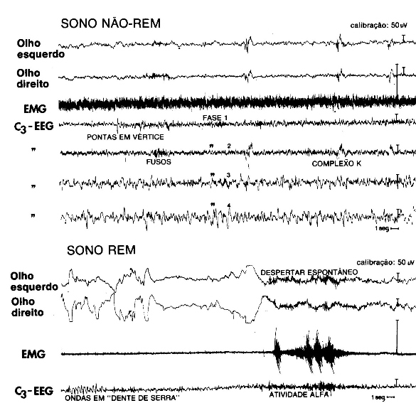 Traçado eletroencefalográfico do sono